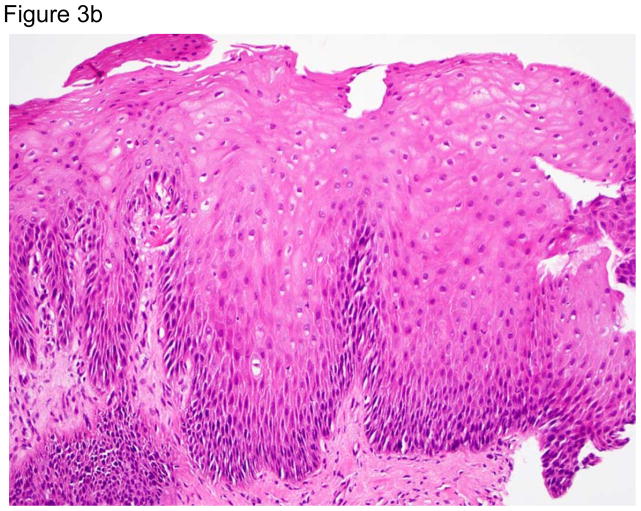 Figure 3a