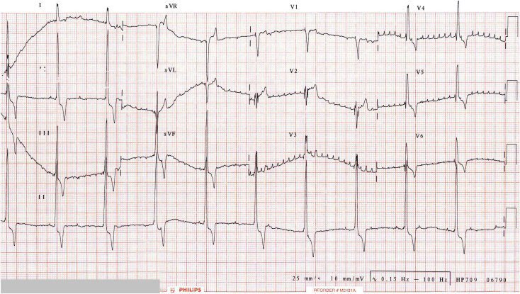 Figure 2