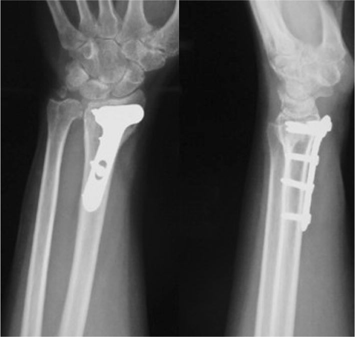 Fig. 4