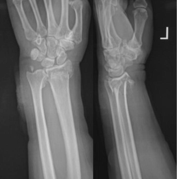 Fig. 3