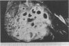 253