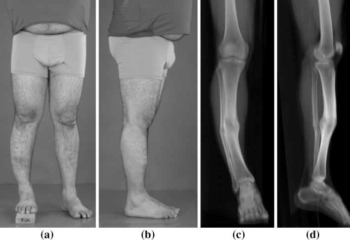 Fig. 1