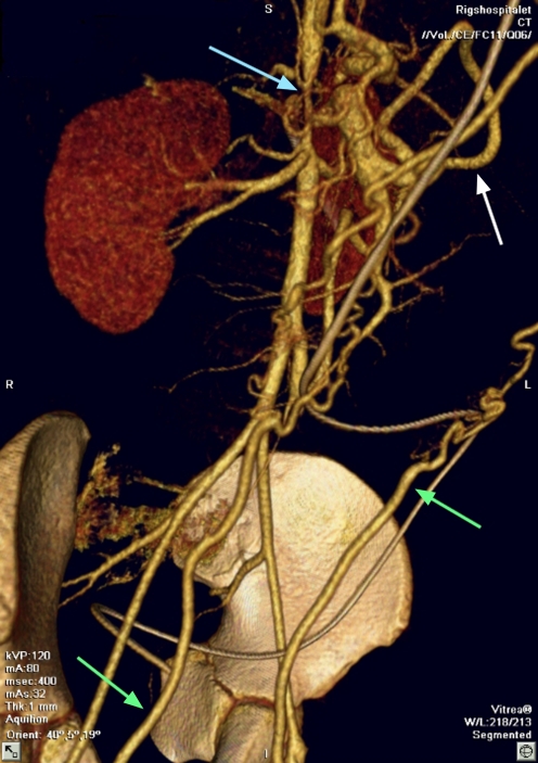 Fig. 3