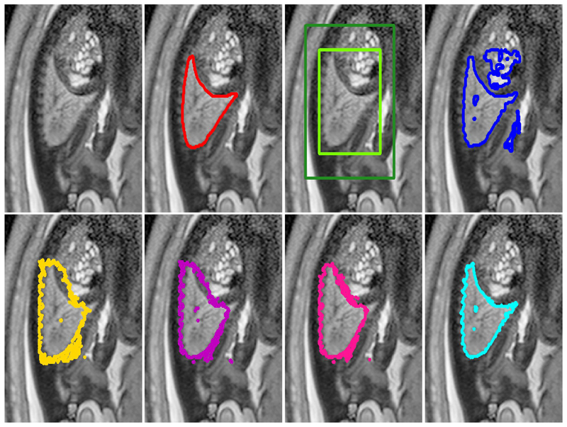 Fig. 4