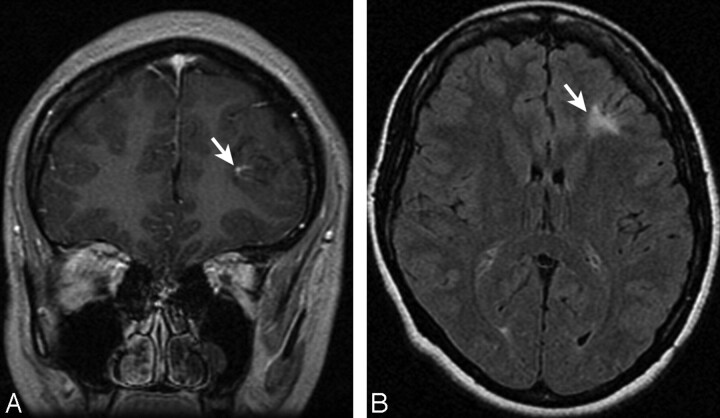 Fig 2.