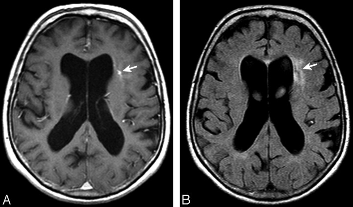 Fig 3.