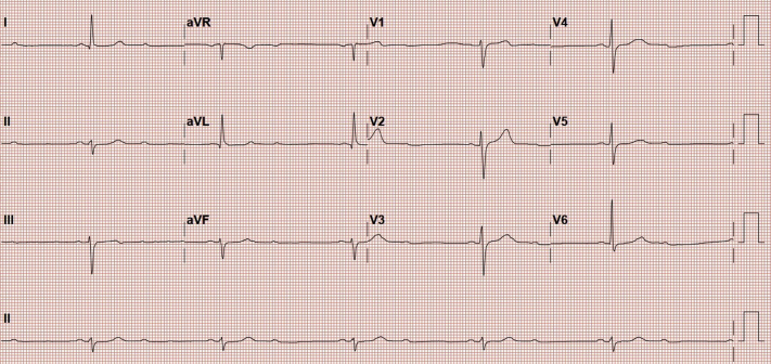 Figure 2