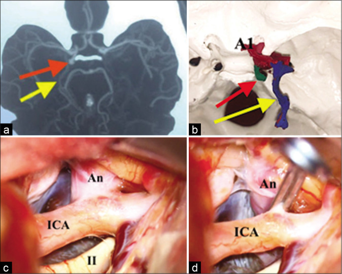 Figure 1: