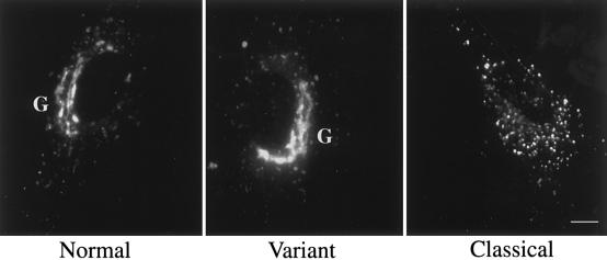 Figure  2