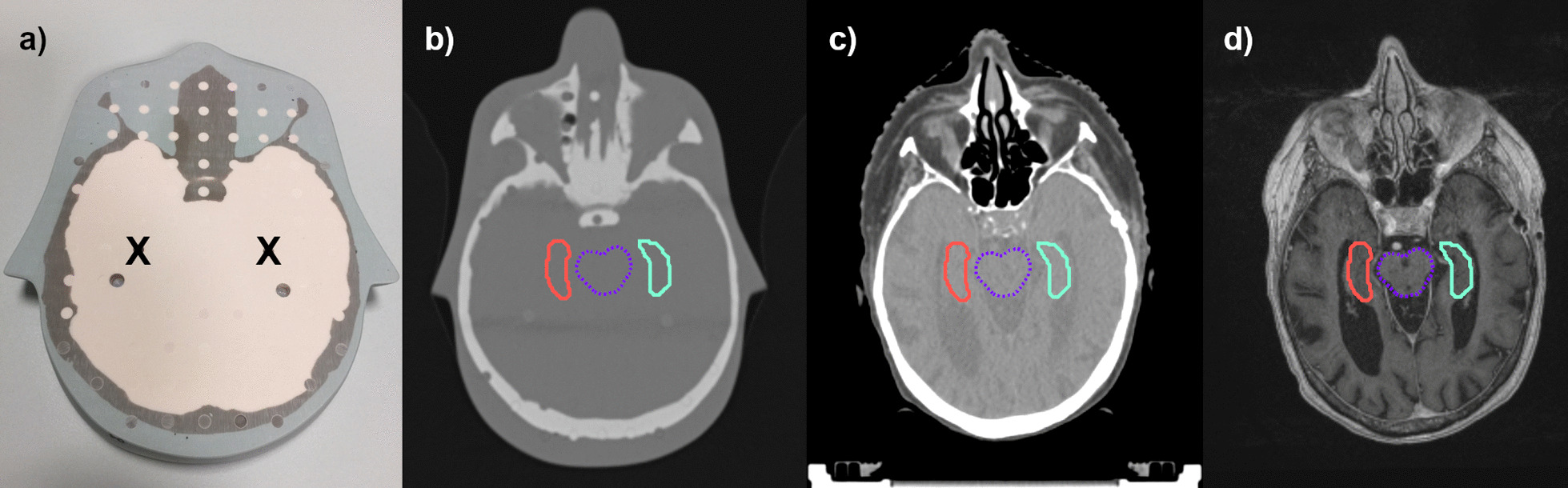 Fig. 2