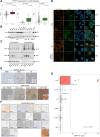Figure 4. ENPP1 is a Ewing sarcoma surface protein with robust expression in Ewing sarcoma compared with other childhood sarcomas and normal pediatric tissues. A, ENPP1 is highly expressed in Ewing sarcoma models from publicly available sources. Points displayed on RNA graphs are limited to the 99th percentile to improve data visualization. P values are from the Wilcoxon signed rank test. B, Western blot analysis depicting elevated expression of ENPP1 in Ewing sarcoma cell lines versus negative control lines (MSC, mesenchymal stem cell; OS, osteosarcoma). Tubulin was used as a loading control. C, ENPP1 is highly expressed in the plasma membrane fractions of three Ewing sarcoma cell lines (A673, CHLA10, and TC32). SiHa, a uterine squamous cell carcinoma cell line, and U2OS, an osteosarcoma cell line, were used as negative controls. ATP1A1 was used as a plasma membrane marker expected to be expressed in all cell lines. Vinculin was used to demonstrate equal loading and successful depletion of the cytosolic fraction. D, Immunofluorescence demonstrating surface staining of ENPP1 in Ewing sarcoma cell lines, with limited expression displayed in non-Ewing sarcoma lines. Tubulin was used as a cytoskeleton marker for all lines. DAPI was used as a nuclear counterstain. E, Representative IHC staining of ENPP1 in a childhood sarcoma cohort, demonstrating variable Ewing sarcoma staining. ARMS, alveolar rhabdomyosarcoma; ERMS, embryonal rhabdomyosarcoma; OS, osteosarcoma; UDS, undifferentiated sarcoma. F, Representative IHC staining of ENPP1 in a tissue microarray (TMA) of 19 Ewing sarcoma tumors, 57 other pediatric cancers, and 21 normal pediatric tissues. G, Plotted are H-scores derived from multiplying the ENPP1 intensity value (0–3) by the percentage of coverage (0–100) in the childhood sarcoma and normal pediatric tissue cohorts. For samples where multiple cores were available, the average of these values was used. Samples are ranked on ascending average H-score. A P value was derived from ANOVA.