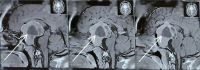 Fig 3: