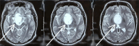 Fig 5: