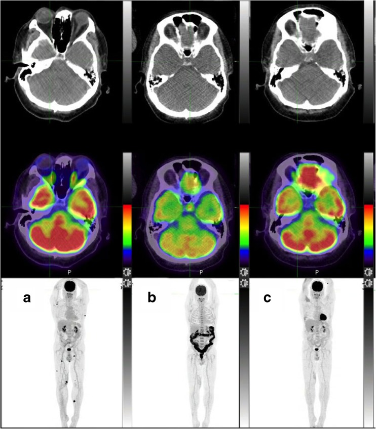 Fig. 3