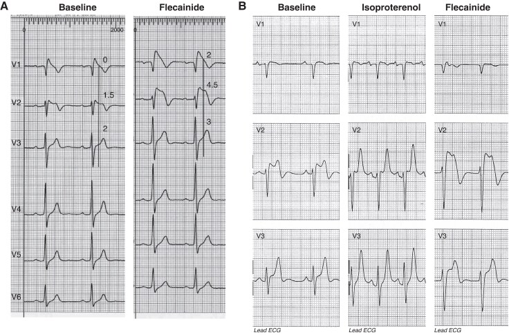 Figure 20