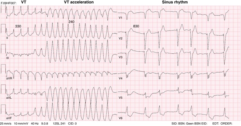 Figure 15