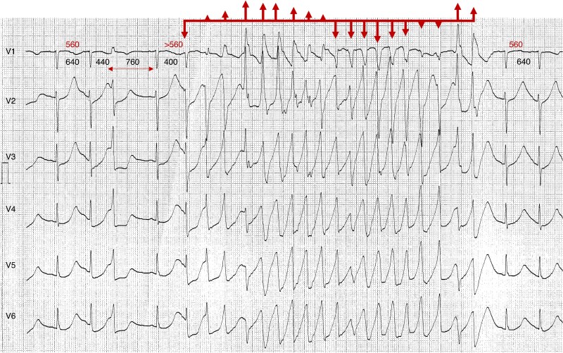 Figure 13