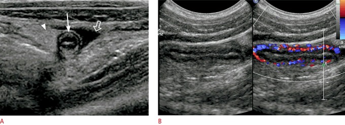 Fig. 14.