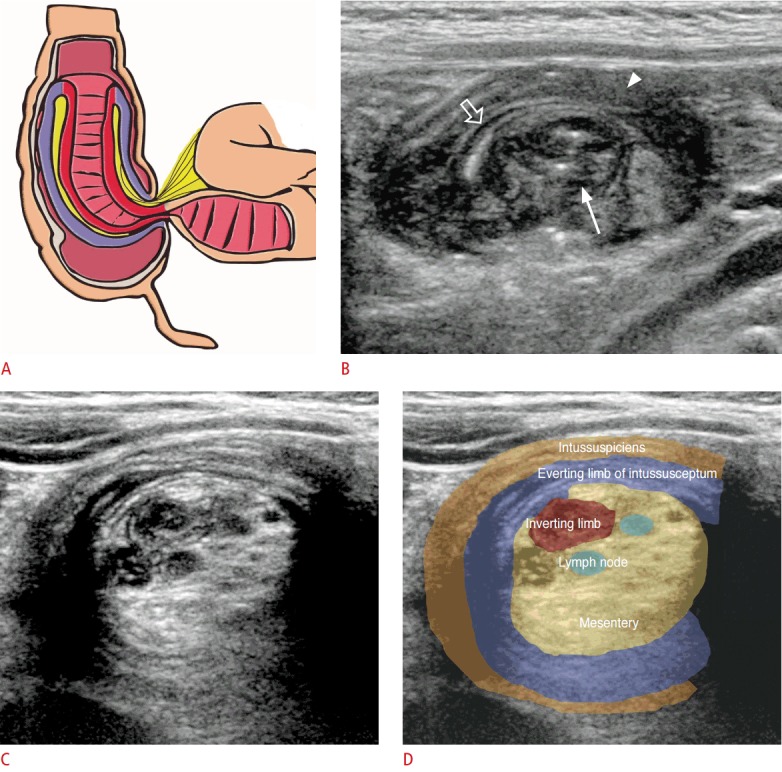 Fig. 11.