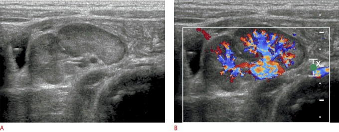 Fig. 17.