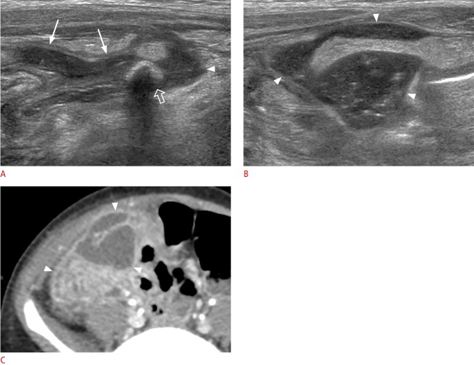 Fig. 16.