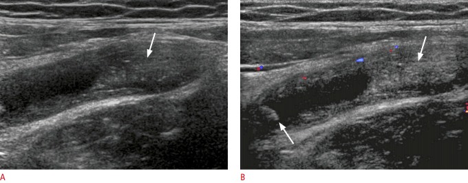 Fig. 15.