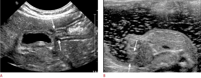 Fig. 10.