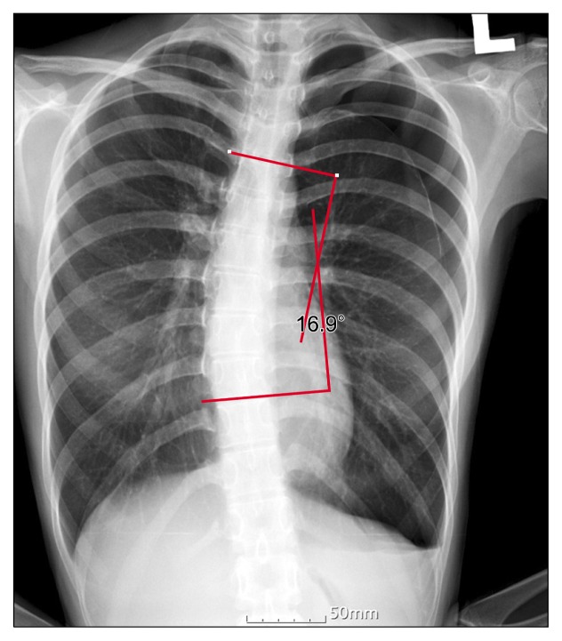 Fig. 1