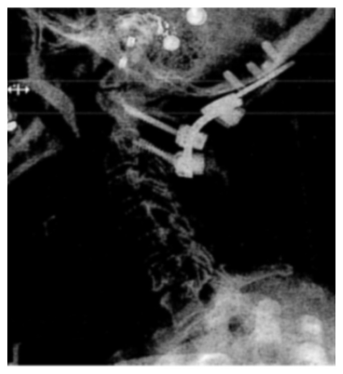 FIGURE 3