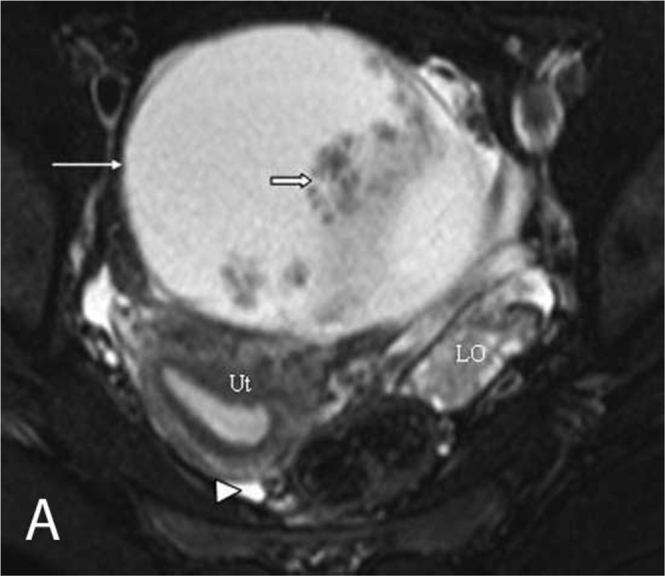 Figure 3A