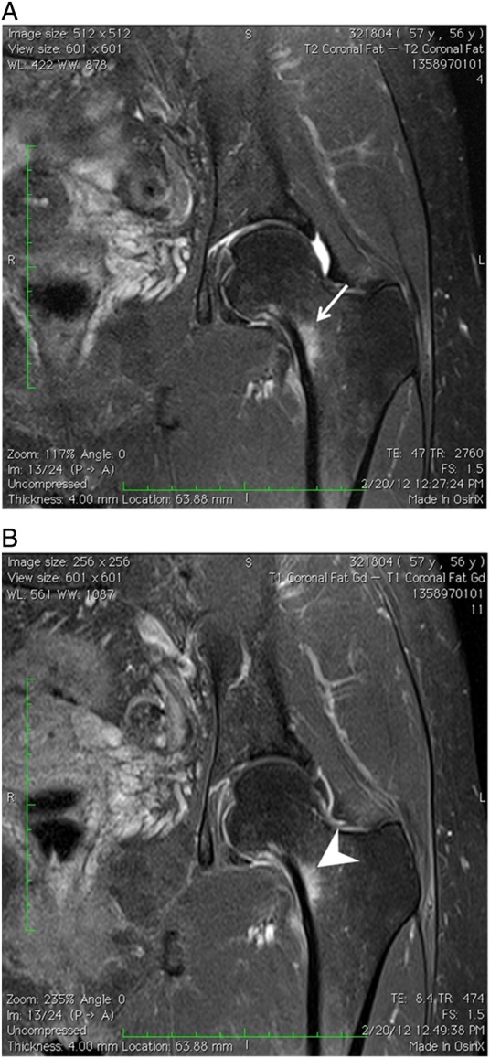 Figure 2