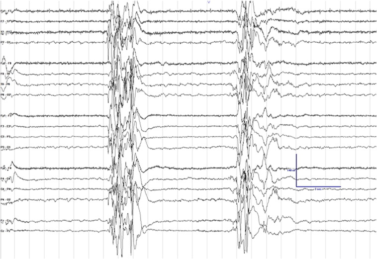 Fig. 1