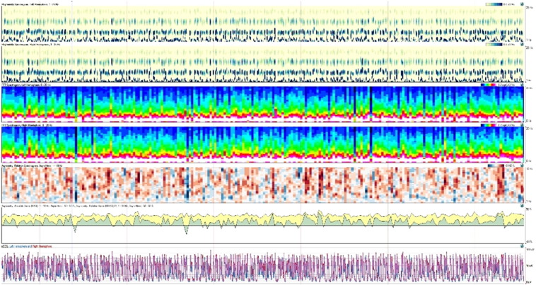 Fig. 2