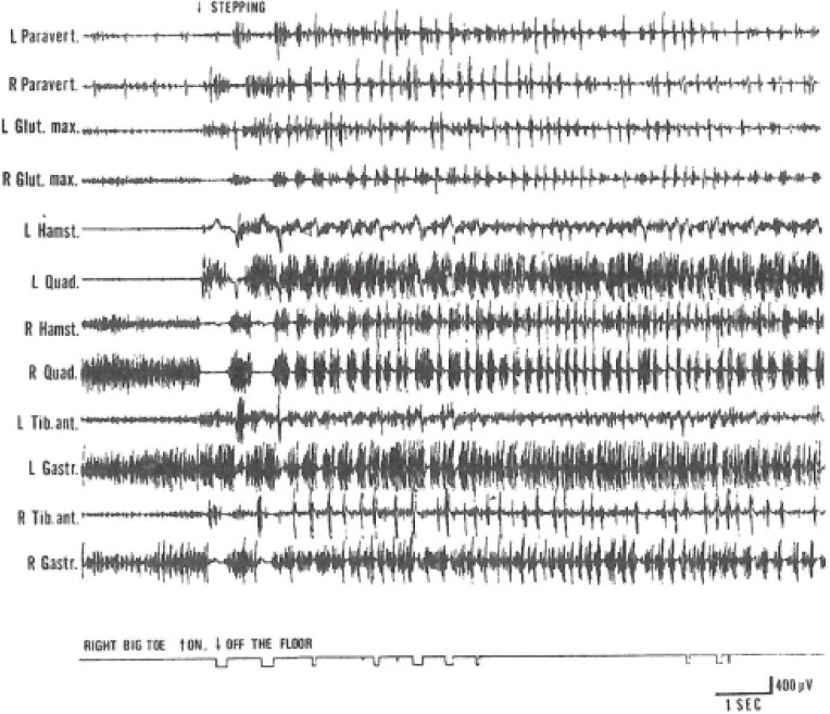 Figure 17. 