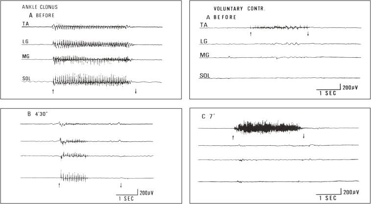 Figure 23. 