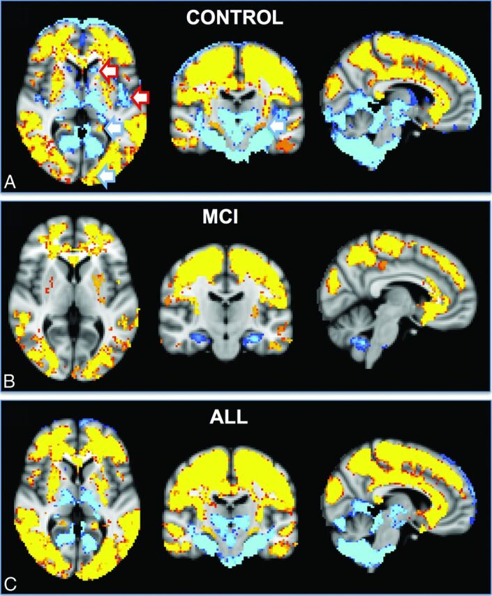 Fig 4.