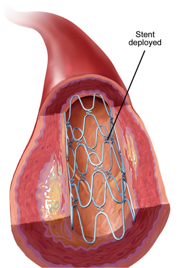 Figure 11