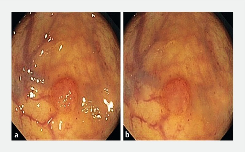 Fig. 3 