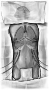 Fig. 36