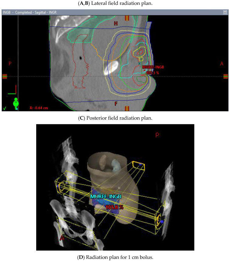 Figure 10