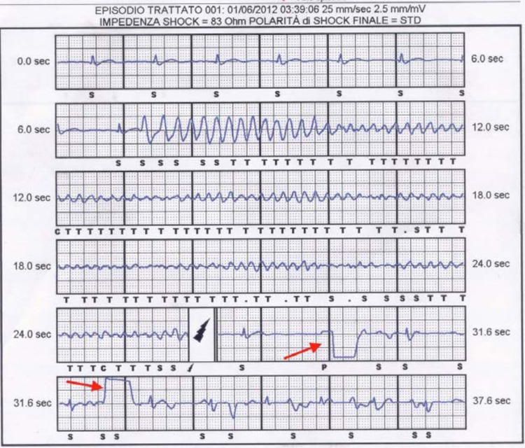 Fig. (5)