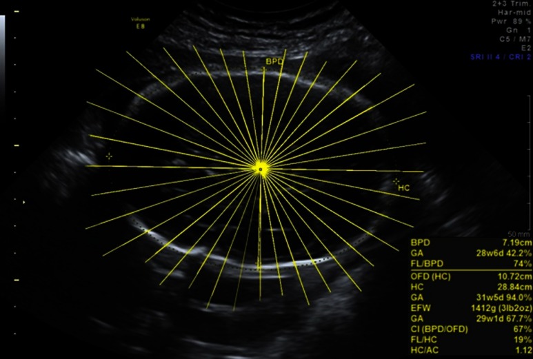 Fig. 6