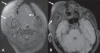 Figure 5 (A, B)