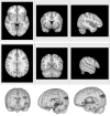 Fig 2.