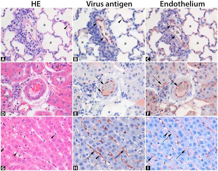 Seoul Virus Tropism and Pathology in Naturally Infected Feeder Rats - PMC