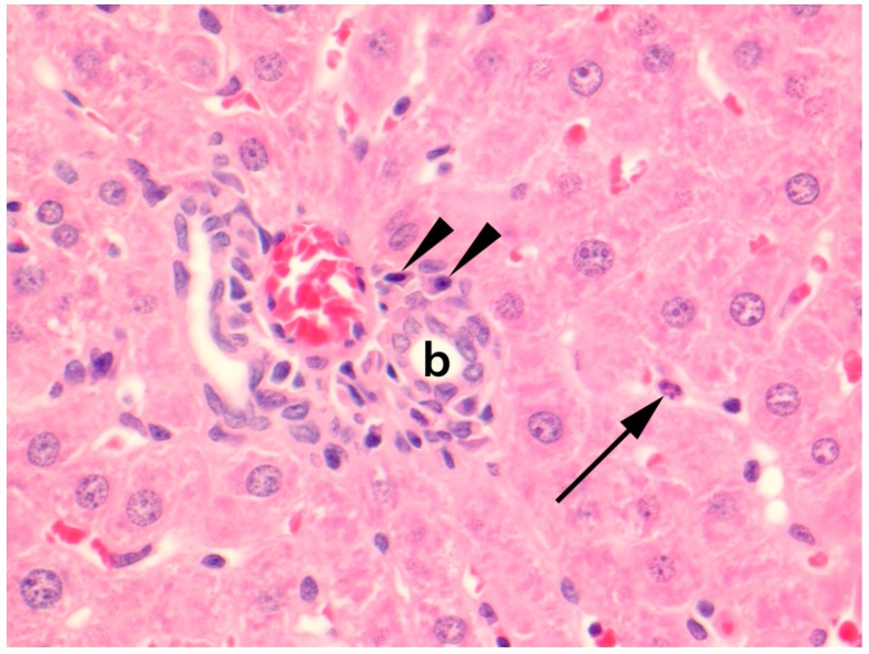 Seoul Virus Tropism and Pathology in Naturally Infected Feeder Rats - PMC