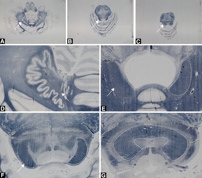 Fig. 3