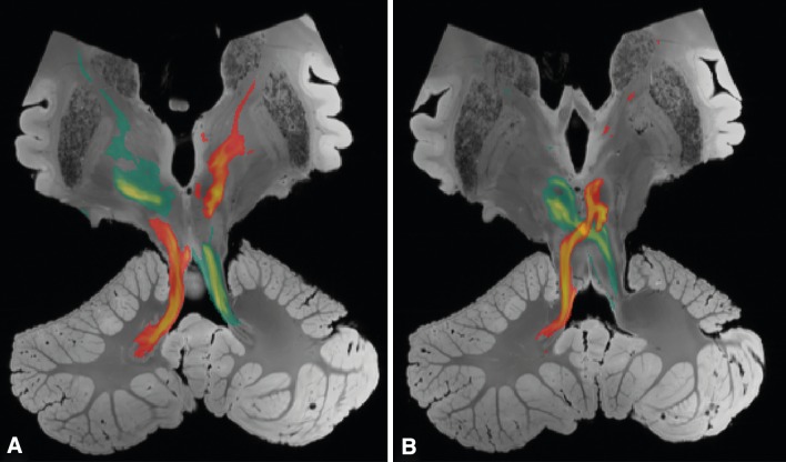 Fig. 2