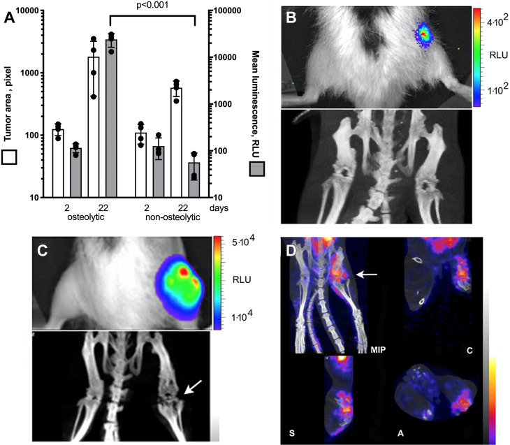 (A–D) Multimodality imaging characterization of osteolytic and nonosteolytic fLuc-MDA-MB-231 tumors. (A) Graph shows that bioluminescence imaging (BLI) in tumors shows differences between osteolytic phenotype (high mean bioluminescence signal) and nonosteolytic phenotype (low bioluminescence signal) at 2 and 22 days after implantation. Mean data are ± standard deviation (four rats per group). (B) BLI scan (top) and CT image (bottom) in lower extremities, nonosteolytic tumor phenotype. (C) BLI scan (top) and CT image (bottom) in lower extremities, osteolytic tumor phenotype; the bone subjected to osteolysis is shown (arrow). (D) A representative SPECT/CT image of epidermal growth factor receptor (EGFR)–positive tumor (arrow) in the knee area of the animal shown in C by using technetium 99–labeled anti-EGFR-F(ab’)2 fragment (fused SPECT/CT image, maximum intensity pixel [MIP]). A = axial image projection, C = coronal, fLuc = firefly luciferase, RLU = relative light unit, S = sagittal.