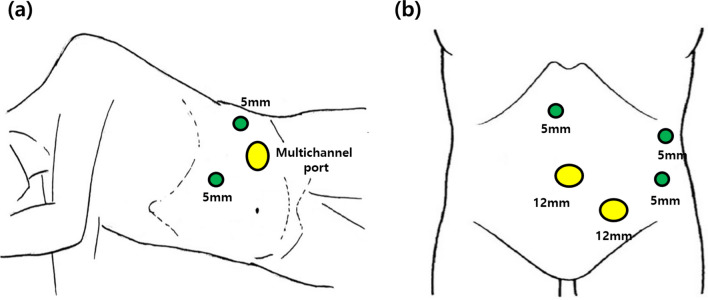 Fig. 1